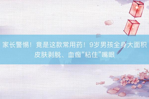 家长警惕！竟是这款常用药！9岁男孩全身大面积皮肤剥脱、血痂“粘住”嘴眼